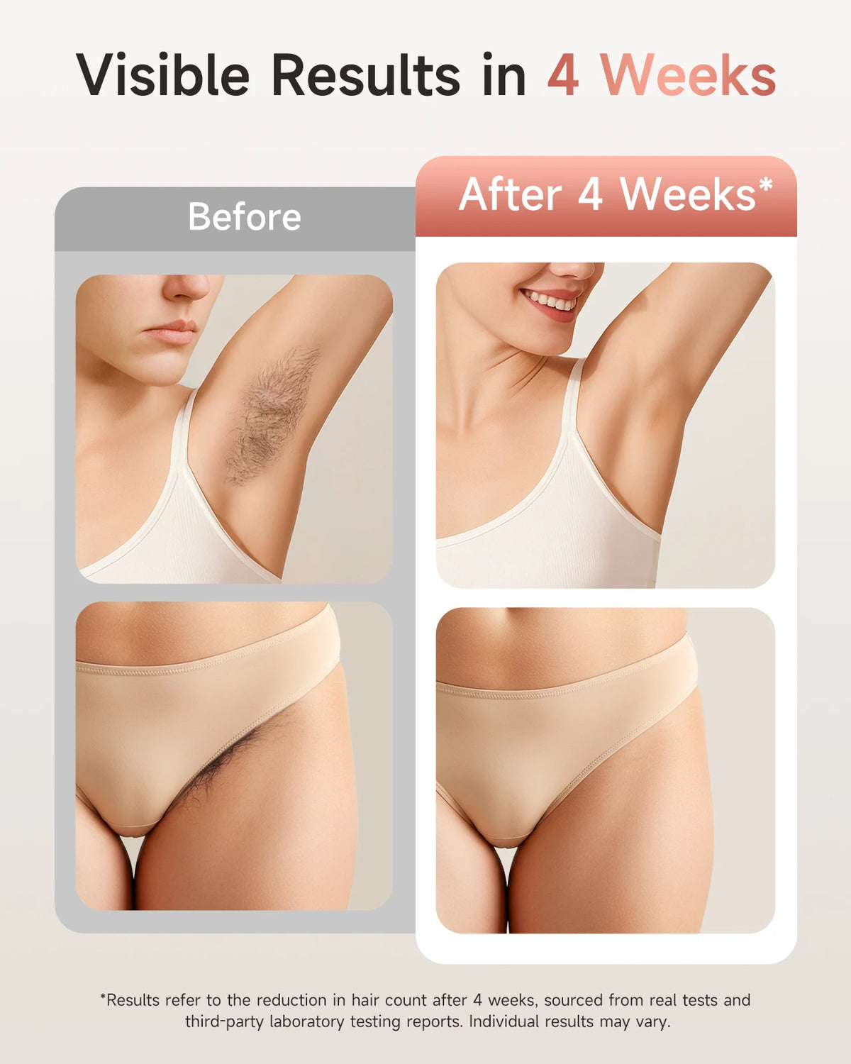 IPL Hair Removal Device 3 in 1 Permanent Hair Removal 999900 Flashes Skin Rejuvenation & Acne Treatment - 9 Energy Levels, 2 Flash Modes Body Bikinis Leg Whole Body Use