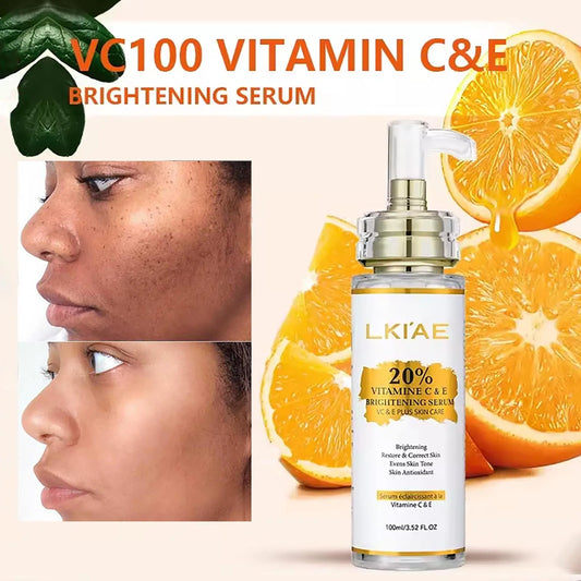 AILKE Vitamin C & E Super Brightening Concentrated Serum, Whitening, Moisturizing, Clean Skin, Reduce Dark Spots, 100ml/3.52 oz