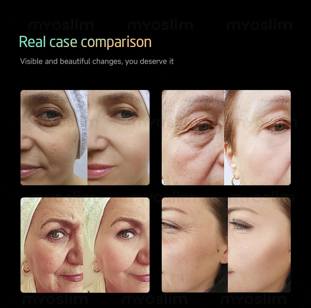 New Technology 3-in-1 Anti-Aging Beauty Machine 15.1 Inch HD Touch Screen Device Skin Tightening